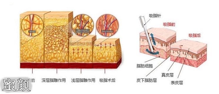 案例图片