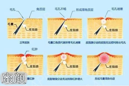 案例图片