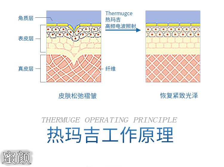 案例图片