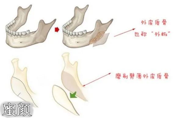 案例图片