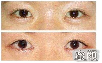 https://img.miyanlife.com/mnt/Editor/2023-09-10/64fd1aa88b4f8.jpg