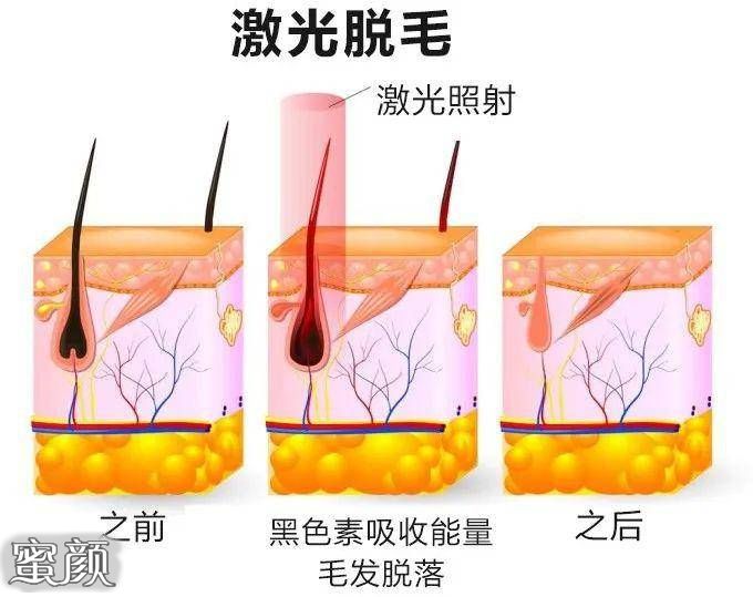 案例图片