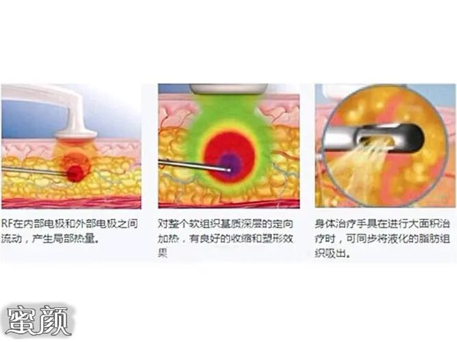 案例图片