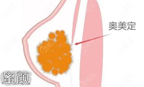 案例图片