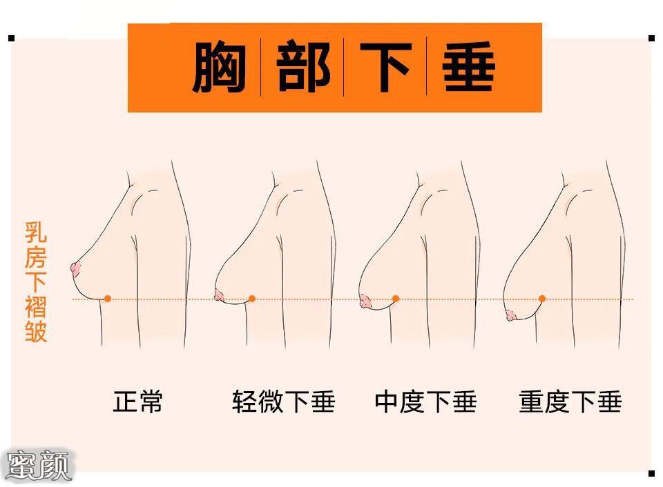 案例图片