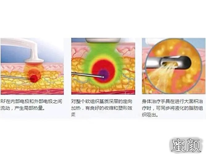 案例图片