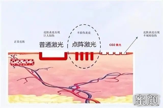 案例图片