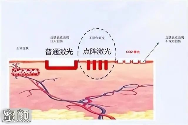 案例图片