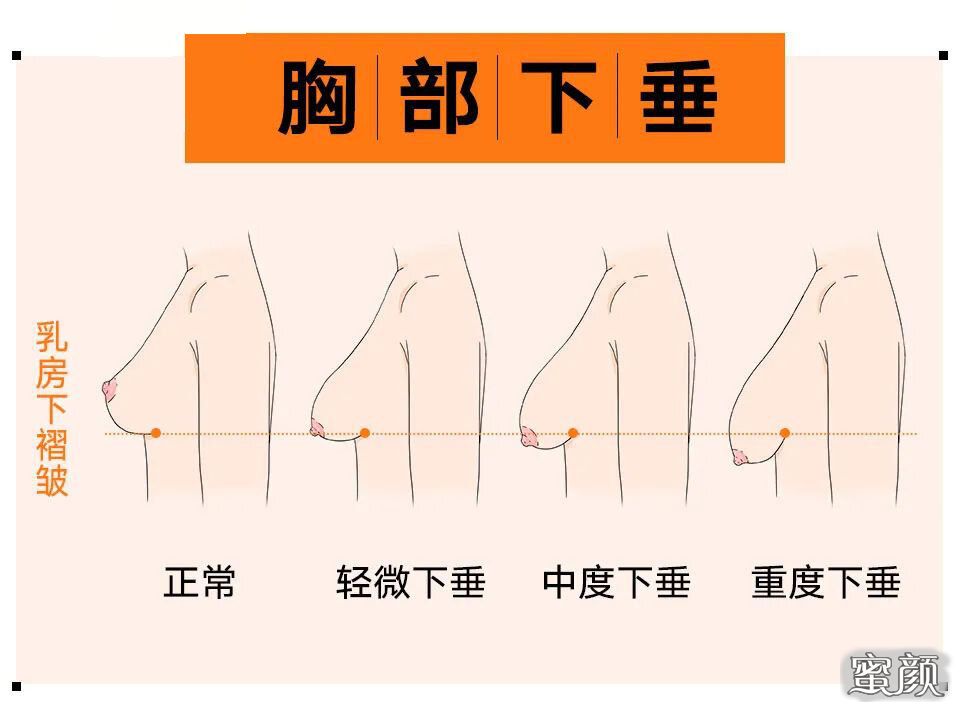 案例图片