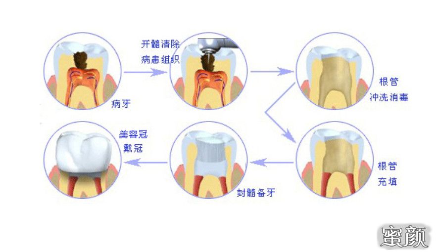 案例图片