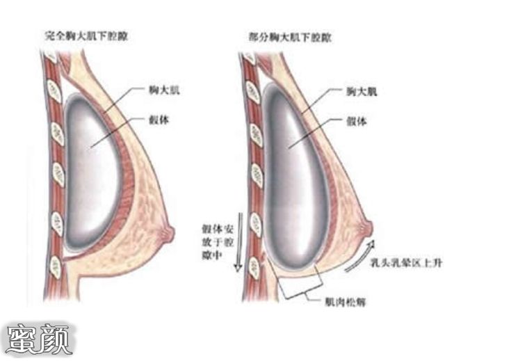 案例图片