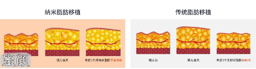 案例图片