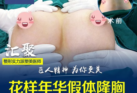 【广州晨曦假体隆胸】