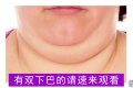 有双下巴怎么办？