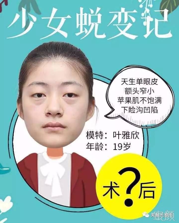 https://img.miyanlife.com/mnt/timg/170516/1FA01D9-0.jpg