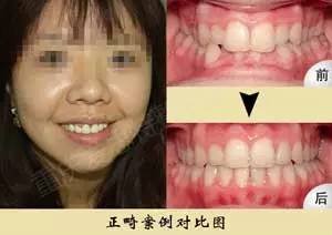 https://img.miyanlife.com/mnt/timg/170521/1T41440U-4.jpg