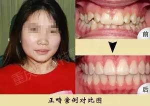 https://img.miyanlife.com/mnt/timg/170521/1T4153240-5.jpg