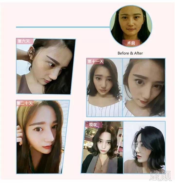 https://img.miyanlife.com/mnt/timg/170521/1U1534c8-6.jpg