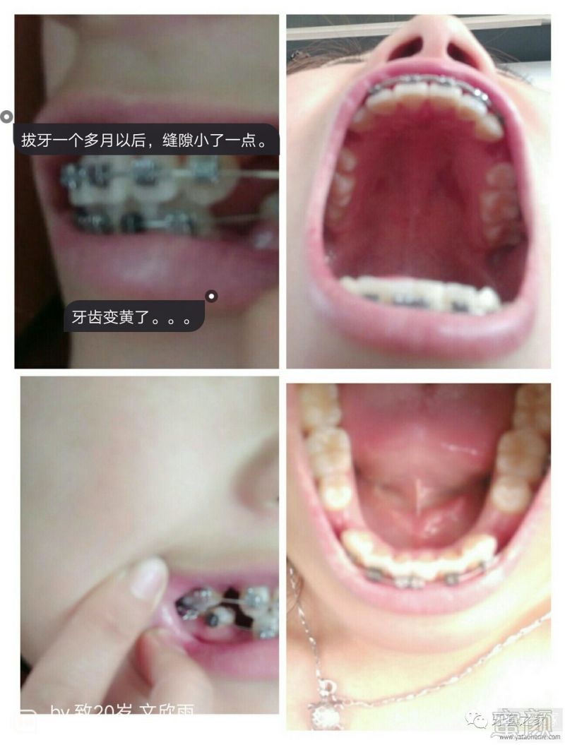 https://img.miyanlife.com/mnt/timg/170528/1235101016-2.jpg
