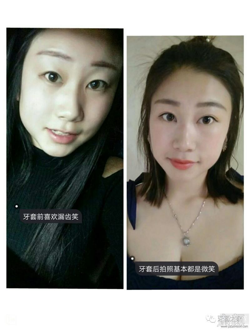 https://img.miyanlife.com/mnt/timg/170528/123513K57-4.jpg