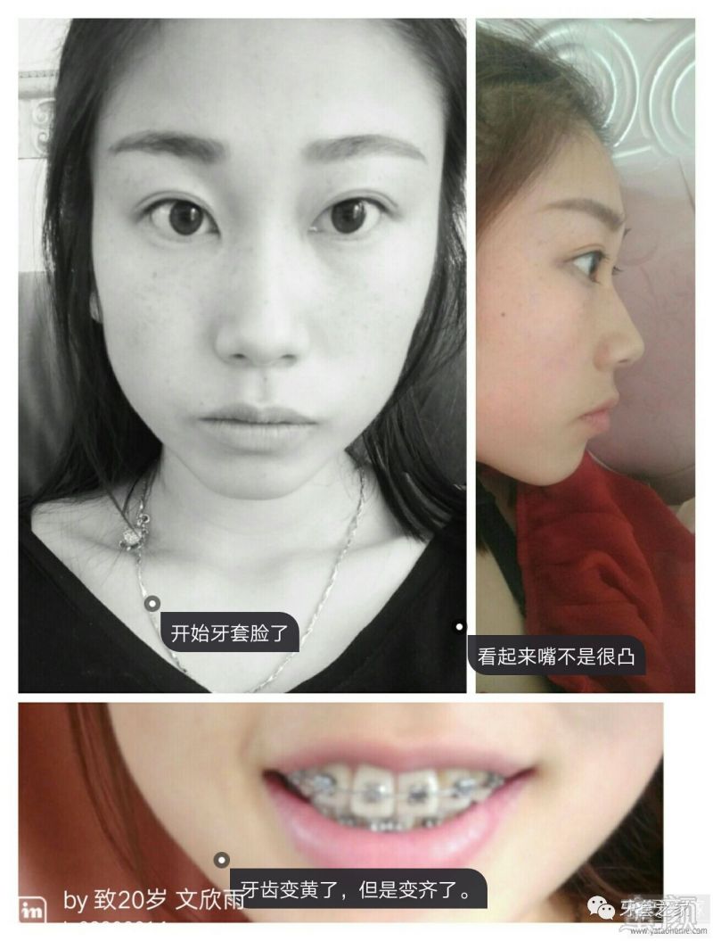 https://img.miyanlife.com/mnt/timg/170528/1235152O1-7.jpg
