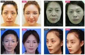 https://img.miyanlife.com/mnt/timg/170530/164A9CX-10.jpg