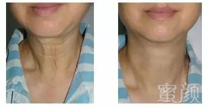 https://img.miyanlife.com/mnt/timg/170530/164AU5P-8.jpg