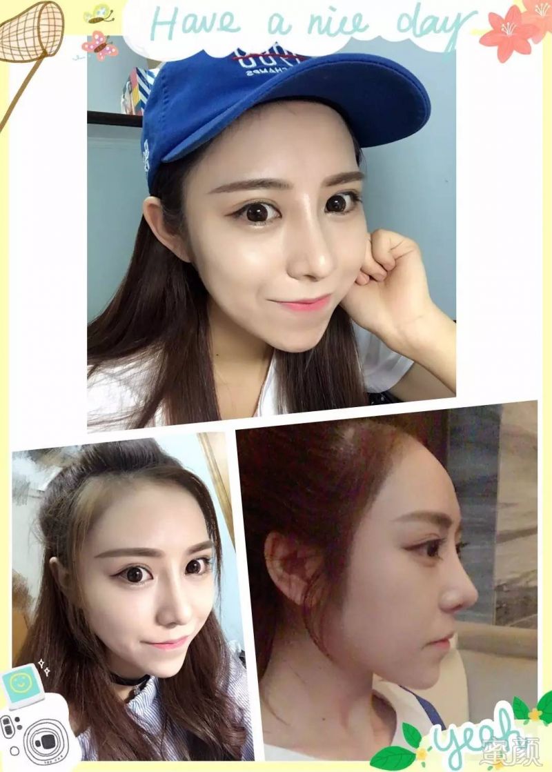 https://img.miyanlife.com/mnt/timg/170601/02431023U-3.jpg