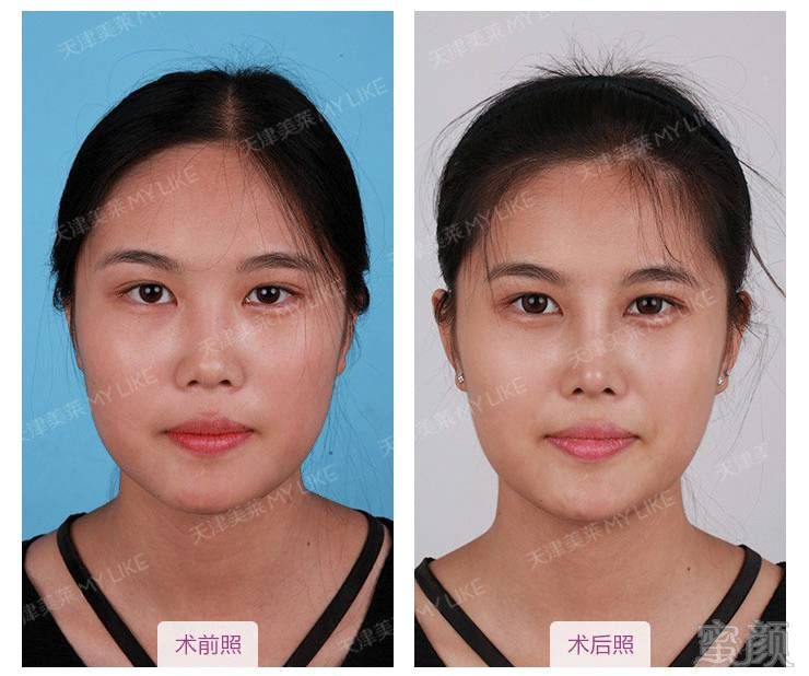 https://img.miyanlife.com/mnt/timg/170601/0243204V3-7.jpg