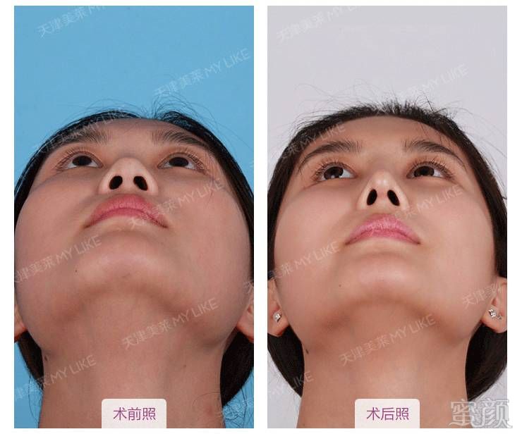 https://img.miyanlife.com/mnt/timg/170601/0243213010-8.jpg
