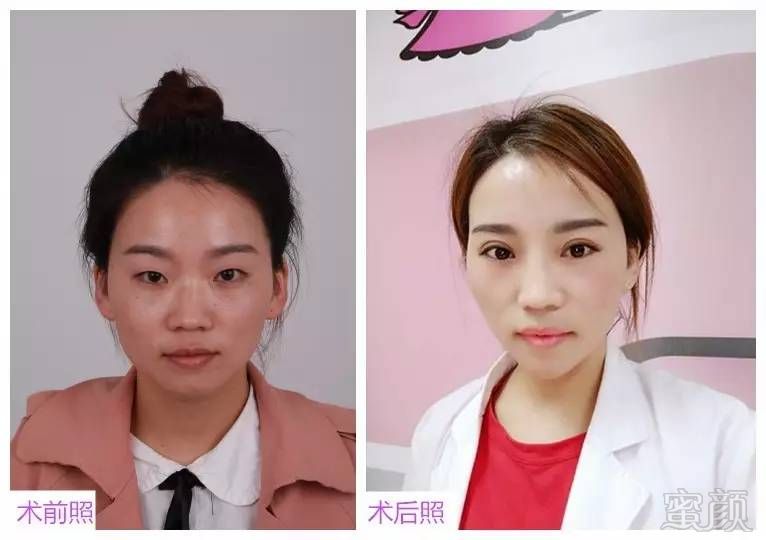 https://img.miyanlife.com/mnt/timg/170601/0243224J6-11.jpg