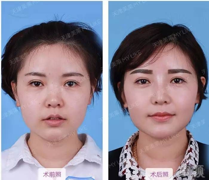 https://img.miyanlife.com/mnt/timg/170601/024323E45-13.jpg