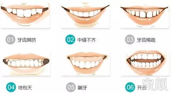 https://img.miyanlife.com/mnt/timg/170601/0254024V9-1.jpg
