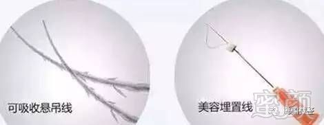 https://img.miyanlife.com/mnt/timg/170602/1434595218-5.jpg