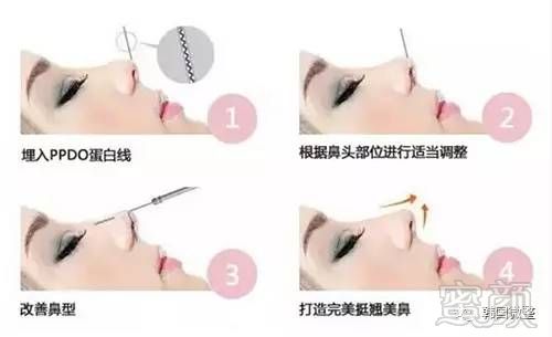 https://img.miyanlife.com/mnt/timg/170602/143500M07-7.jpg