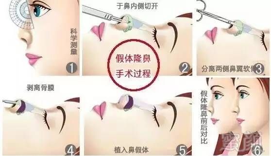 https://img.miyanlife.com/mnt/timg/170602/1U63321E-5.jpg