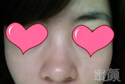 https://img.miyanlife.com/mnt/timg/170603/2004521009-3.jpg