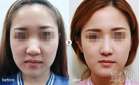 https://img.miyanlife.com/mnt/timg/170603/200455I93-8.jpg