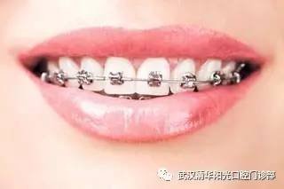 https://img.miyanlife.com/mnt/timg/170605/0FI635Q-4.jpg