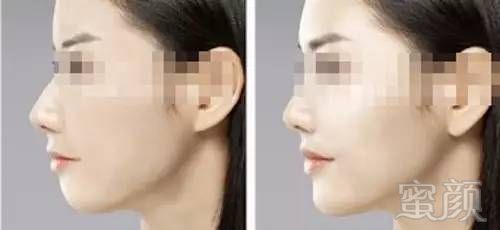 https://img.miyanlife.com/mnt/timg/170605/145KQ248-4.jpg