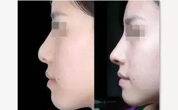 https://img.miyanlife.com/mnt/timg/170605/145KUb2-3.jpg