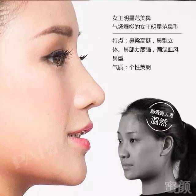 https://img.miyanlife.com/mnt/timg/170606/13234242Q-9.jpg