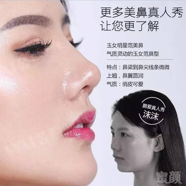 https://img.miyanlife.com/mnt/timg/170606/132342M93-8.jpg