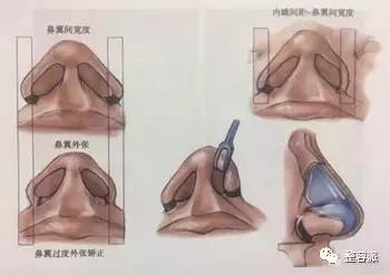https://img.miyanlife.com/mnt/timg/170606/1413251521-6.jpg
