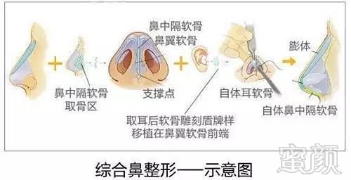 https://img.miyanlife.com/mnt/timg/170606/1435396400-3.jpg