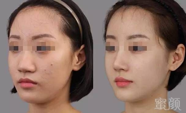https://img.miyanlife.com/mnt/timg/170606/1439454543-11.jpg