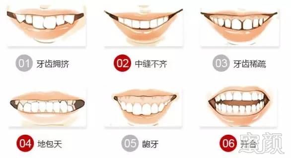 https://img.miyanlife.com/mnt/timg/170607/13114H959-0.jpg