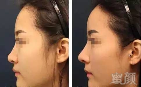 https://img.miyanlife.com/mnt/timg/170607/224Q415C-2.jpg