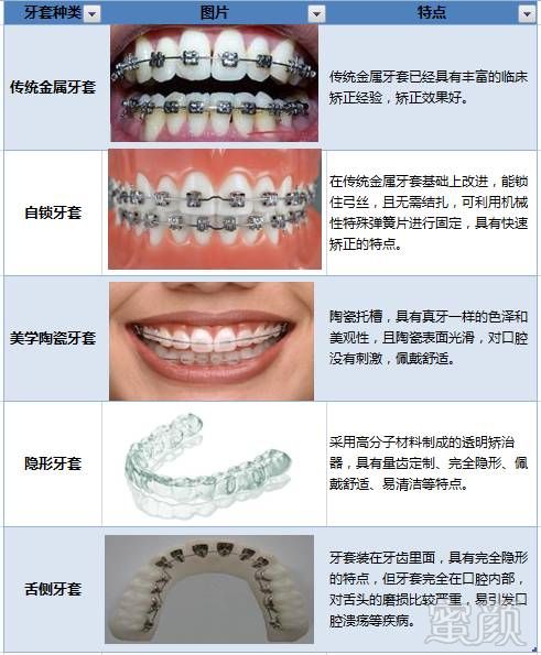 牙齿矫正器种类和图片图片