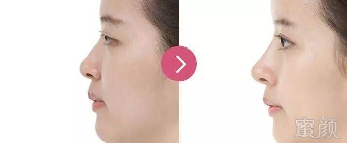 https://img.miyanlife.com/mnt/timg/170608/213R16446-3.jpg